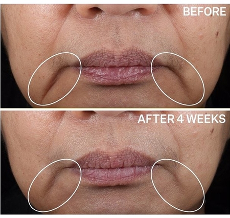 StriVectin Contour Restore™ Tightening & Sculpting Face Cream ultra liftingový pleťový krém