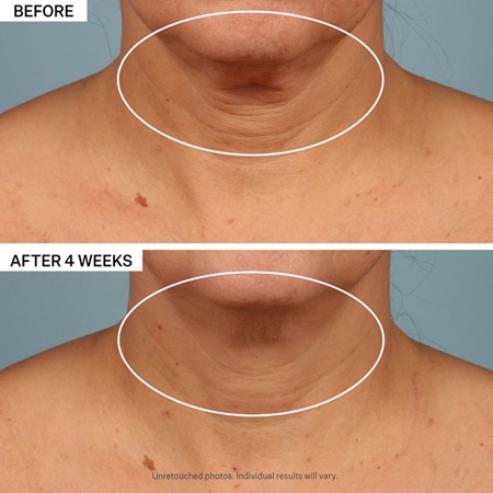 StriVectin Tighten & Lift TL Advanced Tightening Neck Cream Plus liftingový zpevňující krém na krk a dekolt