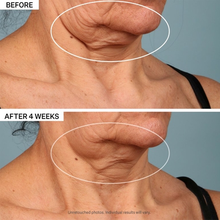 StriVectin Tighten & Lift TL Advanced Tightening Neck Cream Plus lifting krema za učvršćivanje za vrat i dekolte
