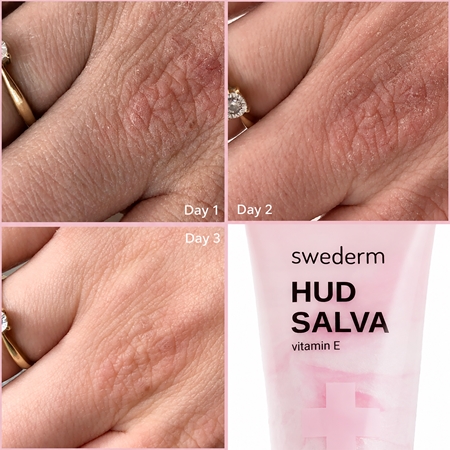 Swederm HUD SALVA Vitamin E охоронний крем для сухої та потрісканої шкіри