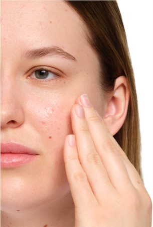The Ordinary Salicylic Acid 2% Anhydrous Solution sérum facial para tom da pele unificado