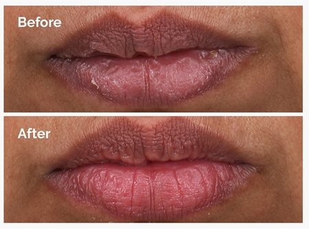 The Ordinary PHA 5% Exfoliating Lip Serum Smoothing Exfoliating Serum for lips