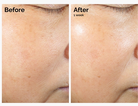 The Ordinary Rice Lipids + Ectoin Microemulsion émulsion légère hydratante pour apaiser la peau