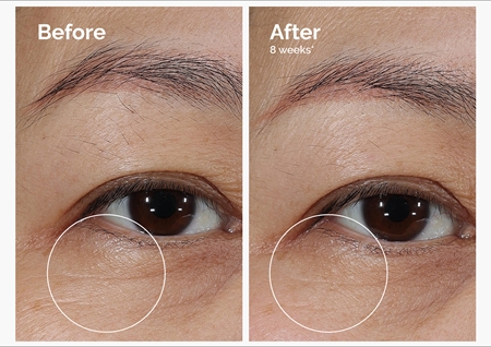 The Ordinary Lacto-PDRN* 4% + B9 Eye Cream Smoothing Eye Cream to treat eye wrinkles