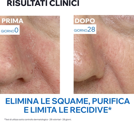 Uriage DS Regulating Soothing Emulsion emulsione lenitiva per la dermatite seborroica