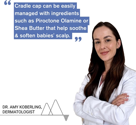 Uriage Bébé 1st Cradle Cap Care Cream nyugtató krém