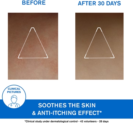 Uriage Xémose Lipid-Replenishing Anti-Irritation Cream relipidační zklidňující mast pro velmi suchou citlivou a atopickou pokožku