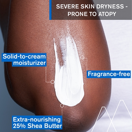 Uriage Xémose Lipid-Replenishing Anti-Irritation Cream relipidační zklidňující mast pro velmi suchou citlivou a atopickou pokožku