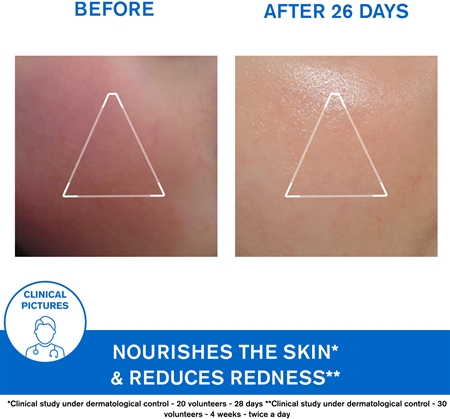 Uriage Xémose Face Cream creme nutritivo para pele muito seca e sensível