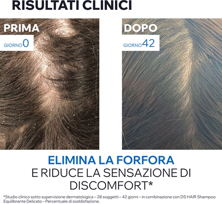 Uriage DS HAIR Anti-Dandruff Treatment Shampoo shampoo antiforfora per cuoi capelluti irritati