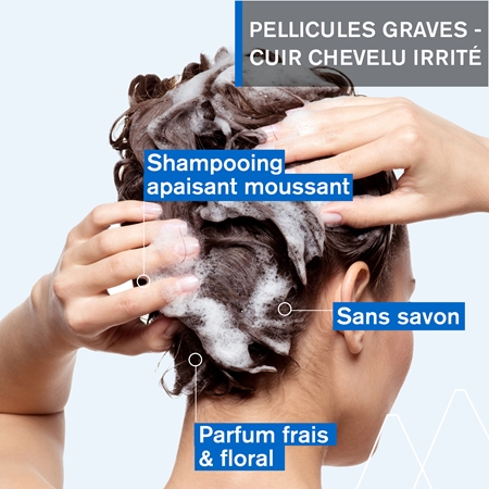 Uriage DS HAIR Kerato-Reducing Treatment Shampoo shampoing kératoréducteur pour peaux sensibles et irritées