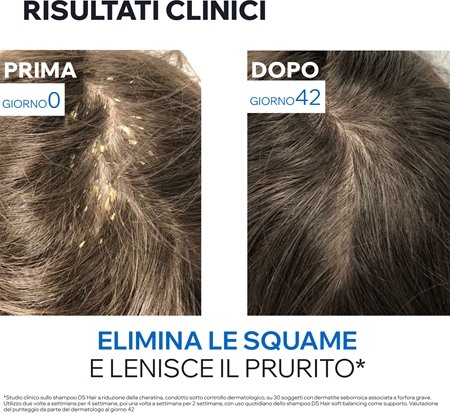 Uriage DS HAIR Kerato-Reducing Treatment Shampoo shampoo cheratolitico per pelli sensibili e irritate
