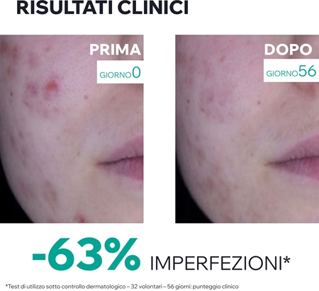 Uriage Hyseac 3-Regul+ Global Anti-Blemish Care crema opacizzante per pelli con imperfezioni