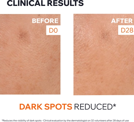 Uriage Dépiderm Anti-Dark Spot Brightening Booster Serum sérum correcteur éclaircissant anti-taches pigmentaires pour une peau lumineuse