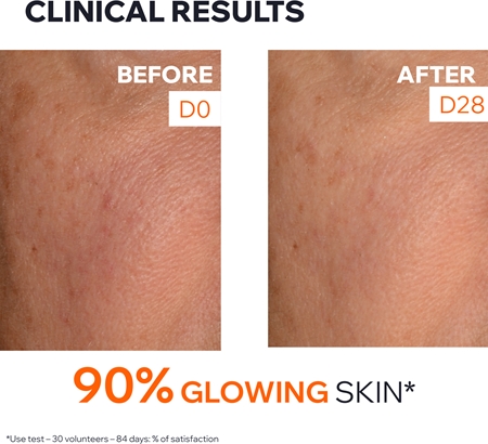Uriage Dépiderm Anti-dark Spot Intensive Care Brown Spots Cream
