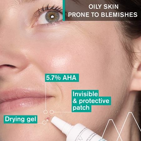 Uriage Hyséac SOS Drying Gel lokální gel na akné proti pigmentovým skvrnám