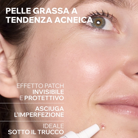 Uriage Hyseac SOS Drying Gel gel per l'acne uso localizzato contro le imperfezioni della pelle