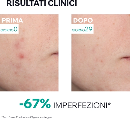 Uriage Hyseac New Skin Serum Anti-Blemish Booster siero per pelli grasse e problematiche