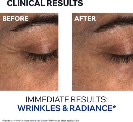 Uriage Age Absolu Blur-redensifying Eye Balm Anti-Wrinkle Cream For The Eye Area