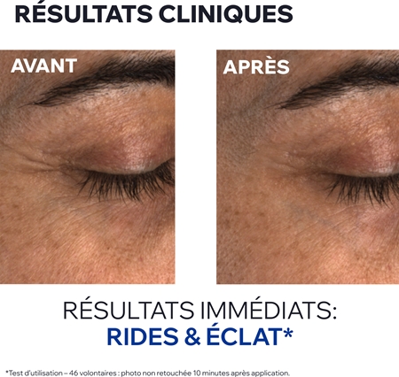 Uriage Age Absolu Blur-redensifying Eye Balm crème anti-rides contour yeux