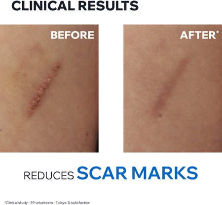 Uriage Bariederm Cica+ Repairing Cream διορθωτική κρέμα με χαλκό και ψευδάργυρο