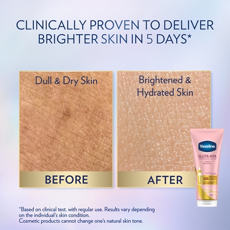 Vaseline Gluta-Hya Dewy Radiance сироватка для тіла | notino.ua