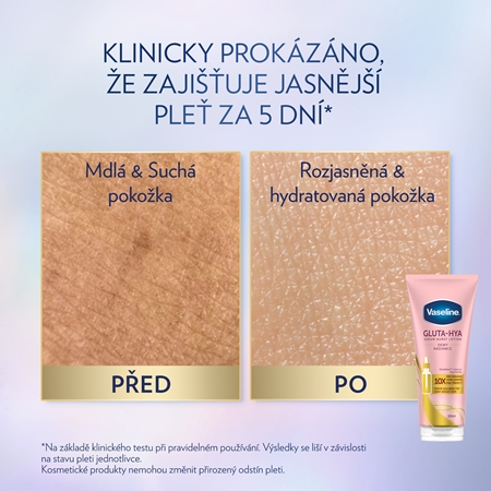 Vaseline Gluta-Hya Dewy Radiance tělové sérum