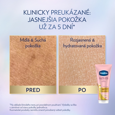 Vaseline Gluta-Hya Dewy Radiance telové sérum