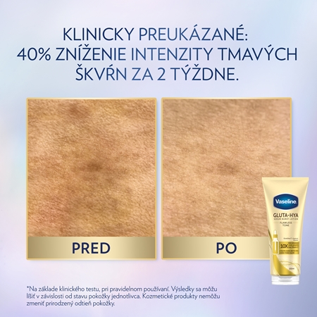 Vaseline Gluta-Hya Flawless Tone telové sérum