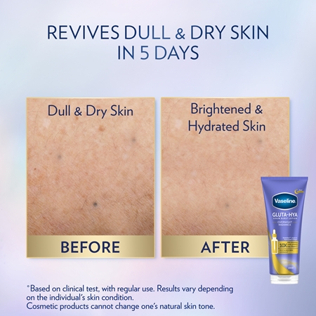 Vaseline Gluta-Hya Overnight Radiance sérum corporel