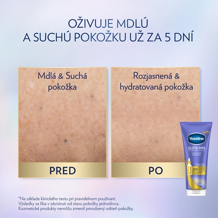 Vaseline Gluta-Hya Overnight Radiance telové sérum