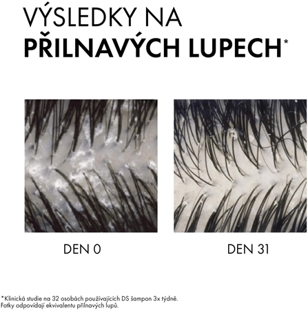 Vichy Dercos Anti-Dandruff šampon proti lupům pro suché vlasy