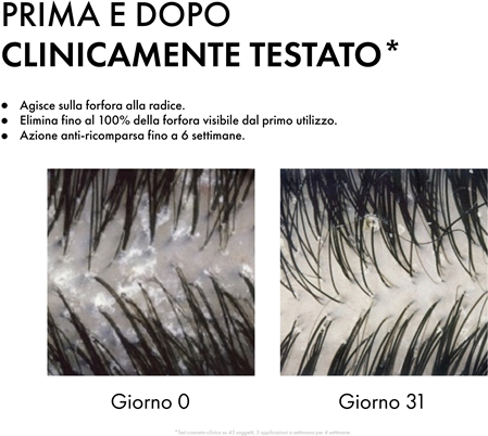 Vichy Dercos Anti-Dandruff shampoo antiforfora per capelli secchi