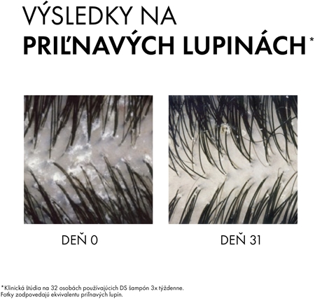 Vichy Dercos Anti-Dandruff šampón proti lupinám pre suché vlasy