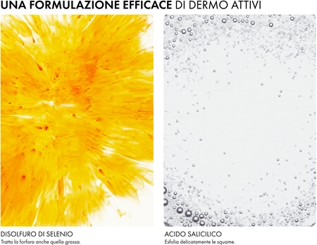 Vichy Dercos Anti-Dandruff shampoo antiforfora per capelli secchi