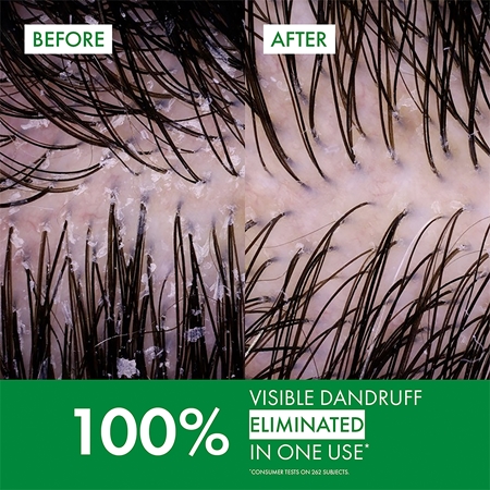 Vichy Dercos Anti-Dandruff szampon przeciwłupieżowy do włosów normalnych i przetłuszczających się