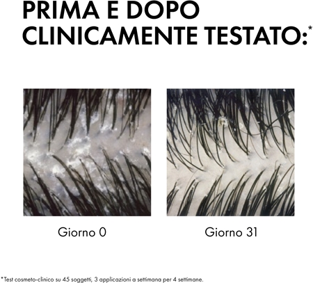 Vichy Dercos Anti-Dandruff shampoo antiforfora per capelli normali e grassi