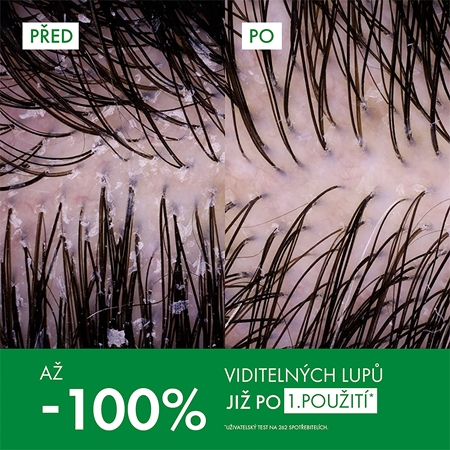 Vichy Dercos Anti-Dandruff sada proti lupům