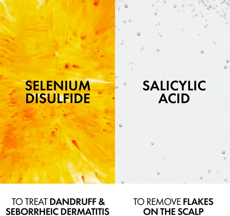Vichy Dercos Anti-Dandruff šampon protiv peruti za normalnu i masnu kosu