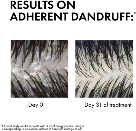 Vichy Dercos Anti-Dandruff šampon protiv peruti za normalnu i masnu kosu