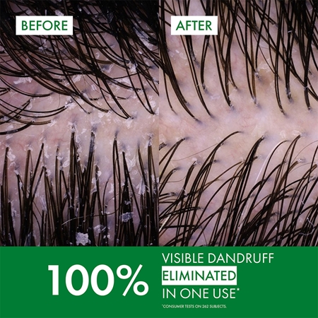 Vichy Dercos Anti-Dandruff szampon przeciwłupieżowy do włosów normalnych i przetłuszczających się
