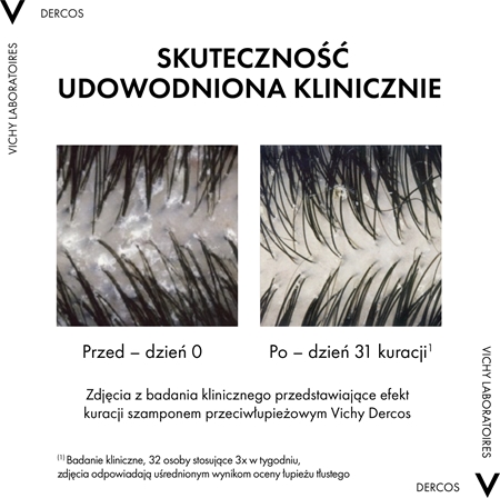 Vichy Dercos zestaw przeciw łupieżowi