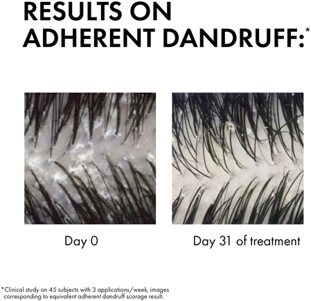 Vichy Dercos Anti-Dandruff Σετ κατά της πιτυρίδας για ξηρά μαλλιά
