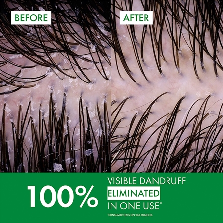 Vichy Dercos Anti-Dandruff szampon przeciwłupieżowy do włosów suchych