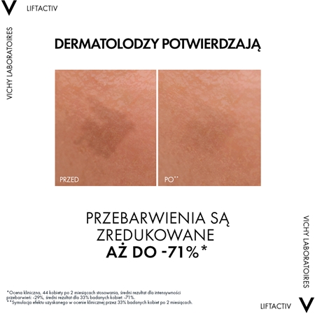 Vichy Liftactiv Pigment Specialist B3 serum do twarzy przeciw przebarwieniom skóry