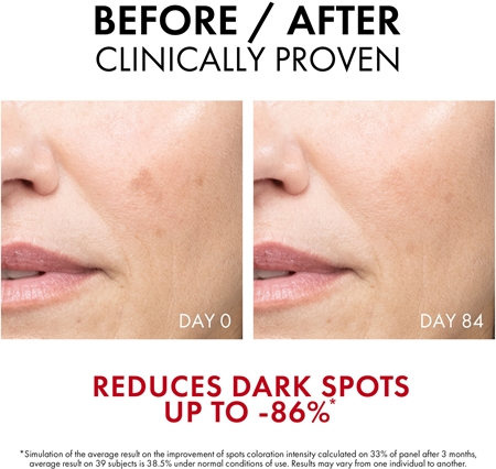 Vichy Liftactiv Pigment Specialist B3 kasvoseerumi pigmenttiläiskien ehkäisyyn