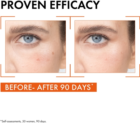 Vichy Liftactiv Supreme sérum illuminateur visage à la vitamine C