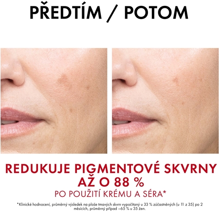Vichy Liftactiv Pigment Specialist B3 intenzivní protivráskový krém proti pigmentovým skvrnám