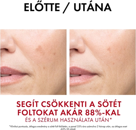 Vichy Liftactiv Pigment Specialist B3 intenzív ránctalanító krém a pigment foltok ellen