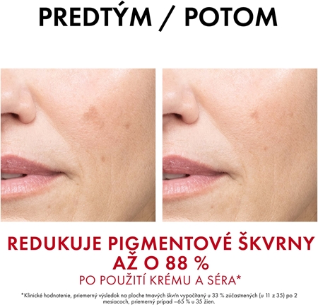 Vichy Liftactiv Pigment Specialist B3 intenzívny protivráskový krém proti pigmentovým škvrnám